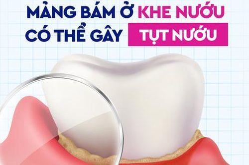 Đánh răng sau khi ăn: Liệu có cần thiết?