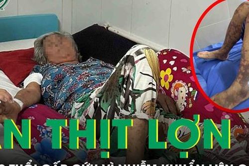 Cấp cứu vì nhiễm khuẩn nguy hiểm sau bữa cơm thịt lợn