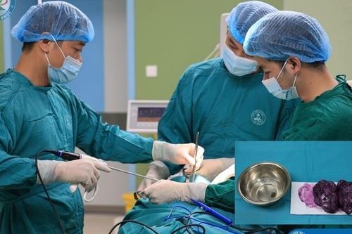 Người phụ nữ 28 tuổi may mắn tránh được nguy cơ biến chứng u tuyến giáp kích thước lớn
