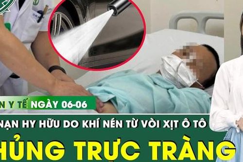 Bản Tin Y Tế 6/6: Hy hữu: Người đàn ông thủng trực tràng do khí nén từ vòi xịt ô tô