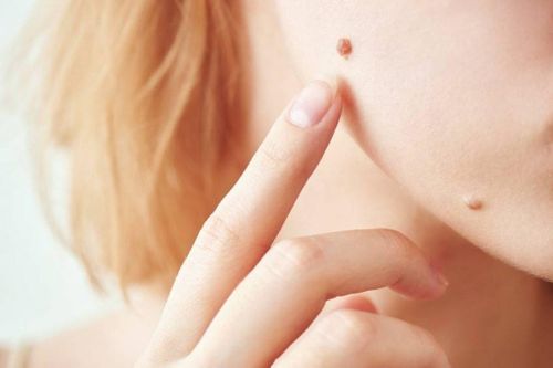 Có 8 dấu hiệu này trên mặt, nên đi khám sớm