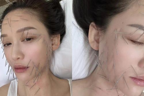 Trần Kiều Ân gây tranh cãi