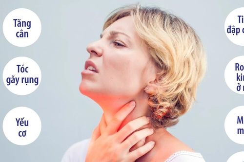 Dấu hiệu cảnh báo bạn có thể đang bị suy giáp