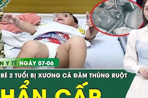 Bản tin Y tế 7/6: Phẫu thuật khẩn cứu bé 2 tuổi bị thủng ruột do xương cá dài 4 cm