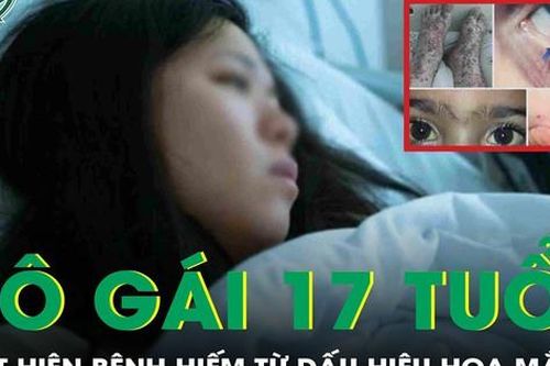 Tưởng hoa mắt do thiếu máu, cô gái 17 tuổi bàng hoàng phát hiện mắc hội chứng Evans hiếm gặp