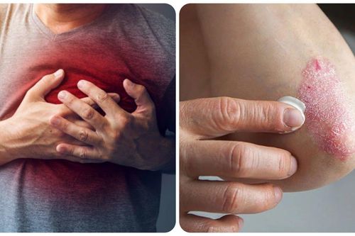 8 dấu hiệu cảnh báo thận không khỏe