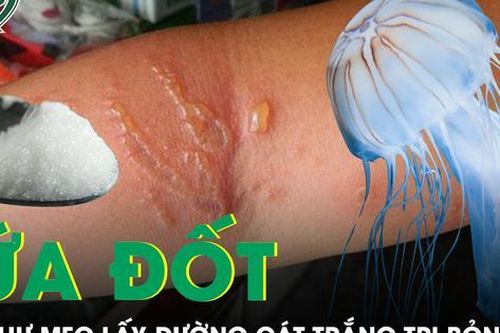 Thực hư mẹo lấy đường cát trắng chà vào vết thương sứa đốt sẽ hết bỏng rát