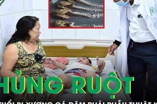 Bé trai 2 tuổi bị xương cá đâm thủng ruột phải phẫu thuật khẩn