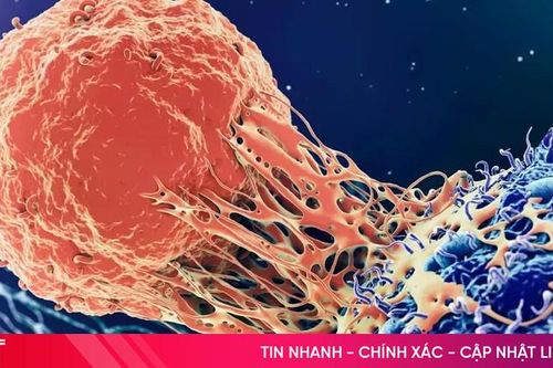 Những bước tiến mới trong điều trị bệnh ung thư