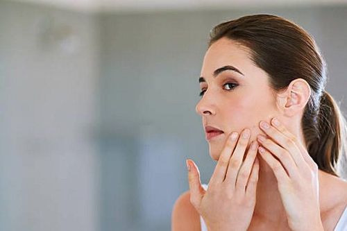 Vị trí nổi mụn trên khuôn mặt cảnh báo điều gì về tình trạng sức khỏe?