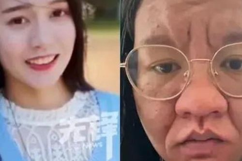 Người phụ nữ gây sốc vì gương mặt như bà lão khi mang thai