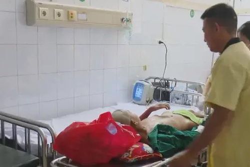 Nhiều trẻ em bị bỏng trong dịp hè