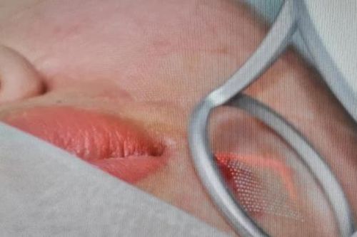 Chấn chỉnh hoạt động của cơ sở y tế, thẩm mỹ viện hành nghề trái phép