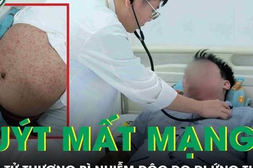 Dị ứng thuốc, nam thanh niên suýt mất mạng do hội chứng hoại tử thượng bì nhiễm độc