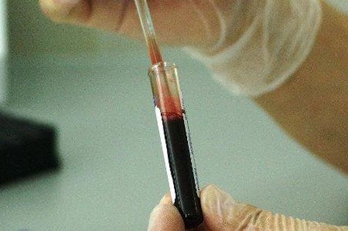 Xét nghiệm máu siêu nhạy của Johns Hopkins phát hiện ADN ung thư sớm 3 năm