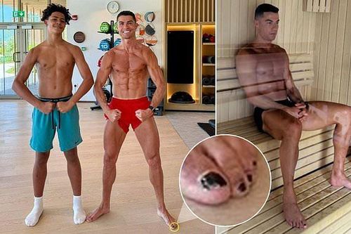Sự thật ít ai ngờ đằng sau việc Ronaldo sơn đen móng chân
