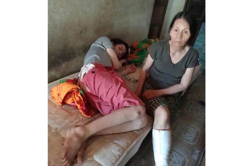 Cả nhà mắc trọng bệnh sau khi mẹ cắt thận ghép cho con trai