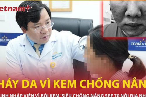 Nữ sinh cháy da vì bôi kem 'siêu chống nắng' mua trên mạng