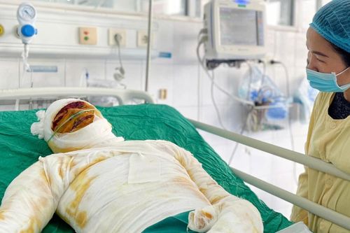 Bát cháo thừa và nước mắt người vợ nghèo bên chồng bị bỏng nặng