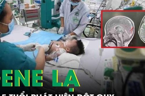 Bé 2,5 tuổi phát hiện đột quỵ do rối loạn di truyền hiếm gặp