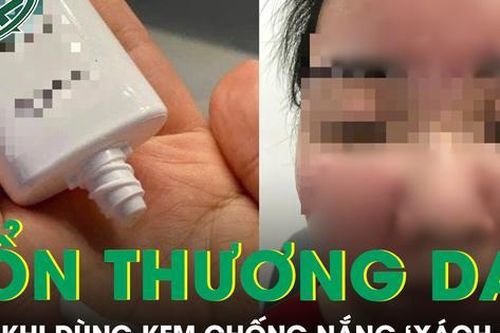 Nữ sinh bị tổn thương da nghiêm trọng sau khi dùng kem chống nắng SPF 70 'xách tay'