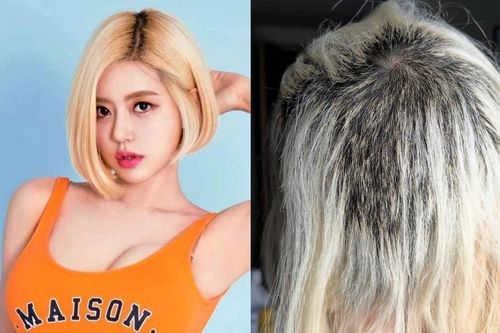 DJ SODA bị trụi cả mảng đầu