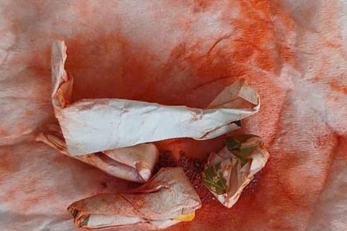 Ngộ độc chì vì uống 'thuốc cam gia truyền'