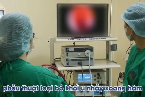 U nhầy xoang hàm lan rộng gây đau đầu, phá hủy hốc mắt