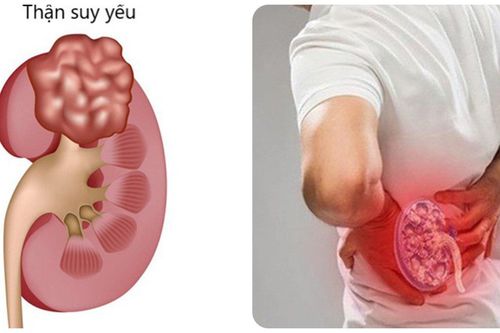 Cách nhận biết thận khỏe hay yếu