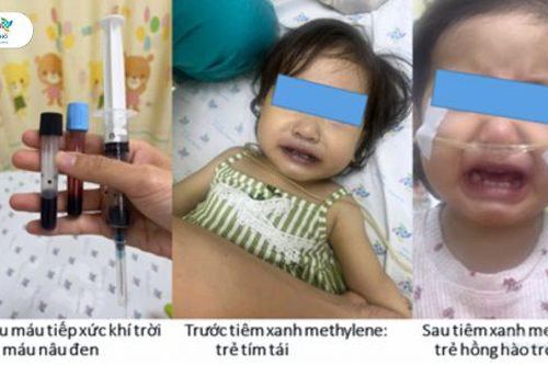 Bé 16 tháng tuổi nguy kịch sau bữa ăn trưa do mẹ nấu, bác sĩ chỉ rõ nguyên nhân