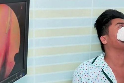 Người đàn ông 40 tuổi hứng chịu đau đầu âm ỉ suốt thời gian dài vì một sai lầm nhiều người Việt mắc phải