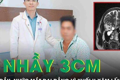 Phẫu thuật cắt u nhầy xoang hàm kích thước lớn xâm lấn sàn sọ hủy xương ổ mắt