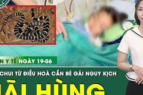 Bản tin Y tế 19/6: Rắn cạp nia chui ra từ điều hòa, cắn bé gái 7 tuổi nguy kịch