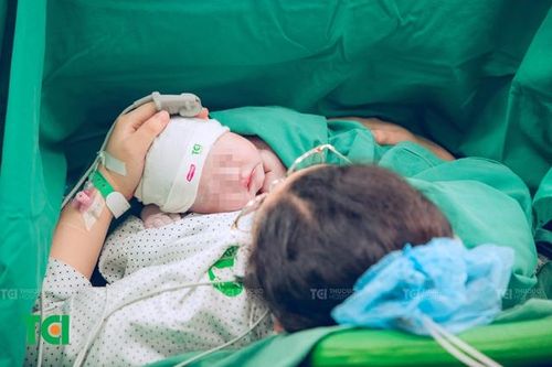 Mẹ đái tháo đường thai kỳ, bé quấn 3 vòng dây rốn, sinh khỏe mạnh