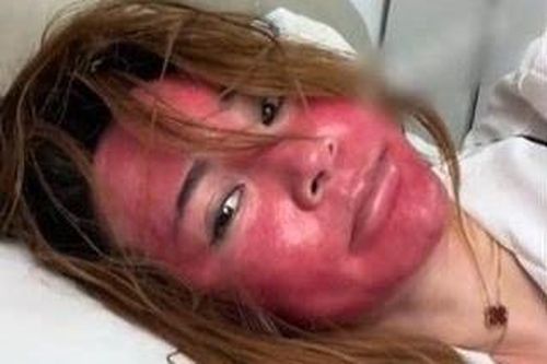 Sốc với khuôn mặt của người phụ nữ Trung Quốc 22 năm không tẩy trang