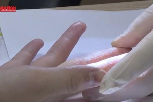Cảnh báo gia tăng các bệnh về da trong mùa mưa