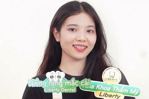Nha khoa Liberty – Ứng dụng công nghệ hiện đại và trang thiết bị tiên tiến vì sức khỏe răng miệng toàn diện