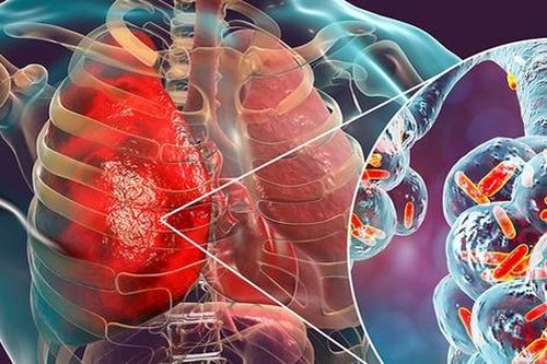 Bé 11 tuổi bất ngờ phát hiện ung thư phổi, nguyên nhân từ một sai lầm mà nhiều nam giới Việt mắc phải