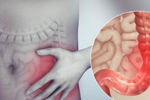 Người đàn ông 67 tuổi ở Hà Nội phát hiện ung thư đại tràng thừa nhận chủ quan với dấu hiệu báo bệnh này