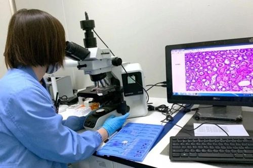Xét nghiệm máu có thể phát hiện sớm nhiều loại ung thư