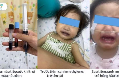 Ăn ghẹ, canh cải nấu với nước giếng, bé gái máu chuyển đen