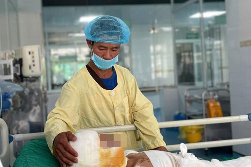 Bố nghèo ôm con bỏng nặng vượt hơn 300 km tìm sự sống