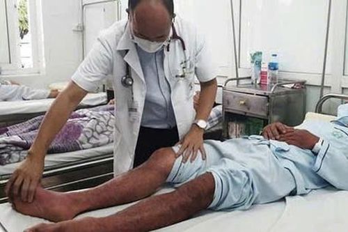 Sốt xuất huyết Dengue: Nguy kịch vì chủ quan