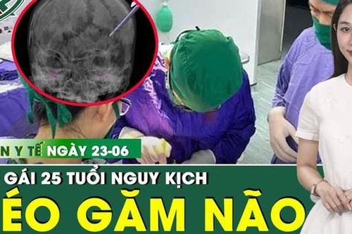 Bản tin Y tế 23/6: Cô gái 25 tuổi bị kéo nhọn đâm xuyên não