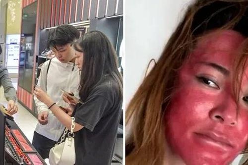 Khuôn mặt của người phụ nữ 22 năm không tẩy trang cho thấy da bị tổn hại thế nào