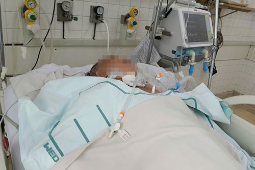 Hai bệnh nhân ở TP.HCM bị viêm não do zona