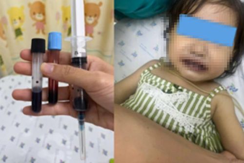 Máu của bé gái chuyển màu nâu đen sau khi ăn canh nấu bằng nước giếng