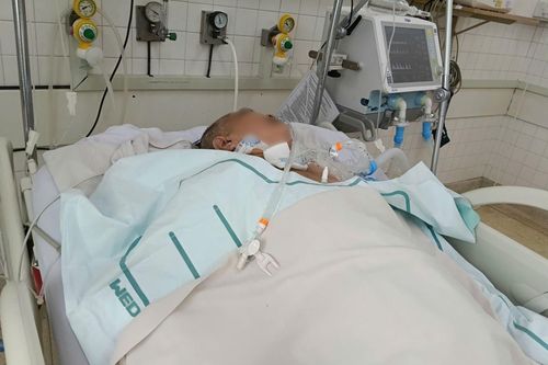 TP Hồ Chí Minh: Gia tăng ca viêm não do zona thần kinh