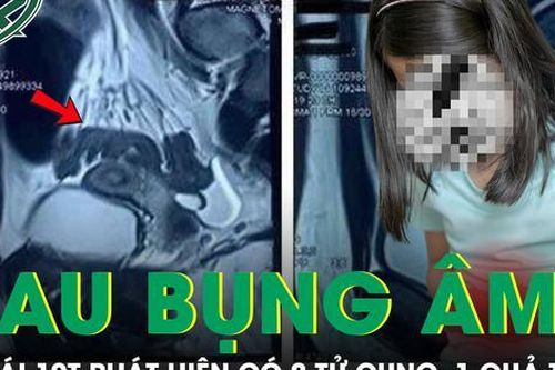 Bé gái 10 tuổi đau bụng âm ỉ, đi khám mới biết có hai tử cung, một quả thận