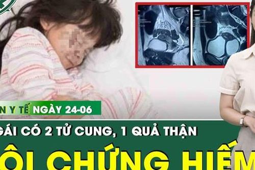 Bản Tin Y Tế 24/6: Bé gái mắc hội chứng hiếm gặp với hai tử cung, một quả thận